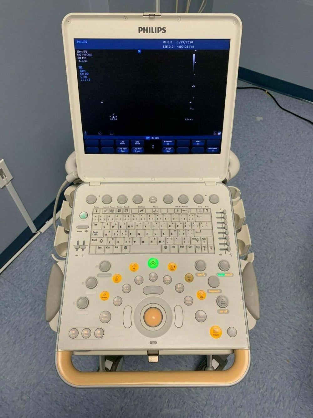 Philips CX50 ultrasound system