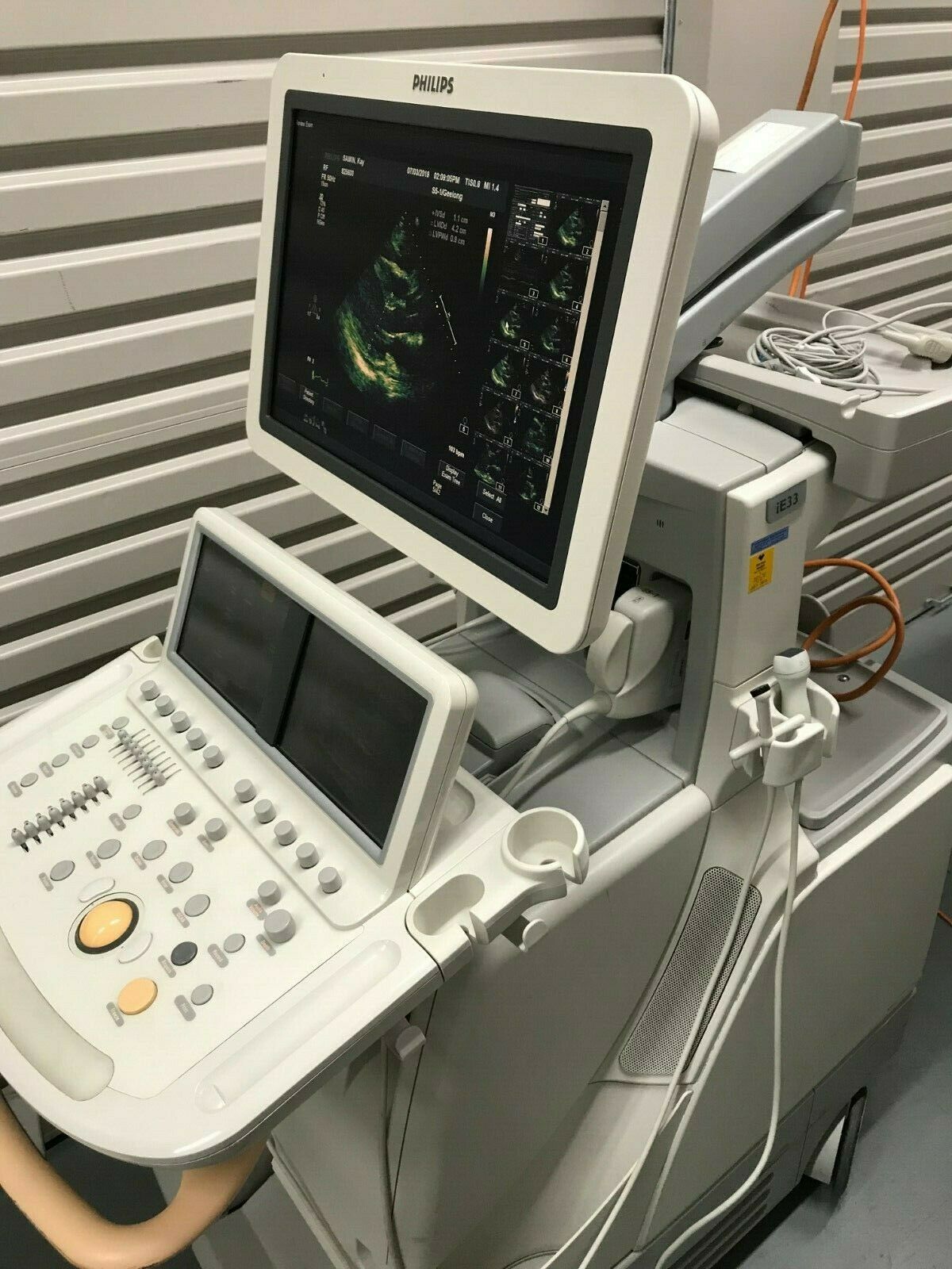 Echocardiogram Machine