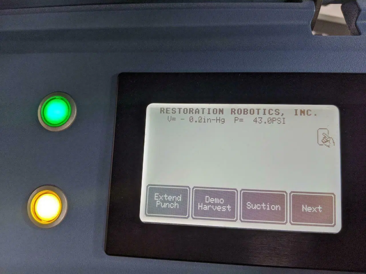 ARTAS iX Robotic Hair Restoration System - Image 6